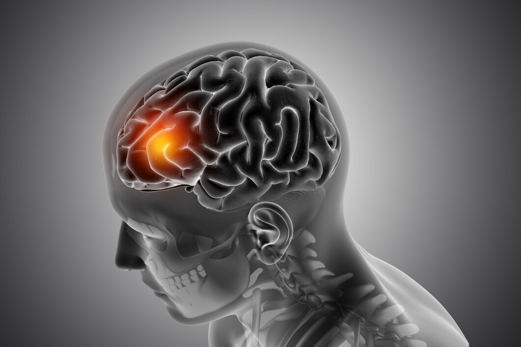 Neurosurgery Treatment in India
